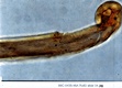 AFDIL Photomicrograph depicting hair root and marked: '99C-0438-46A Roll 3 Slide 04.jpg'