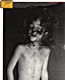 Kimberley MacDonald: Head and neck wounds